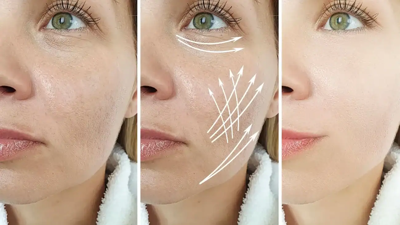 Can One Treatment Really Tackle More Than One Skin Concern Weston Super Mare?