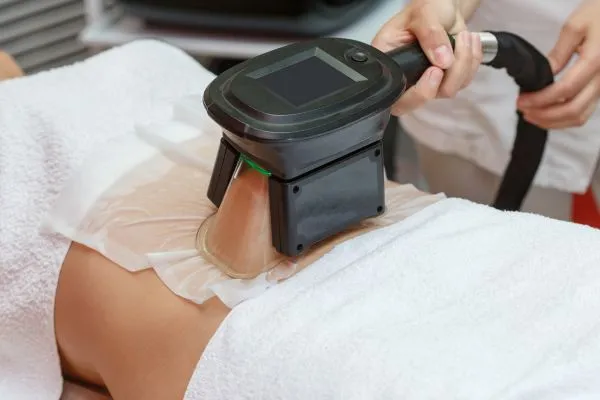 Image of person having fat freezing treatment to help weight gain Weston Super Mare