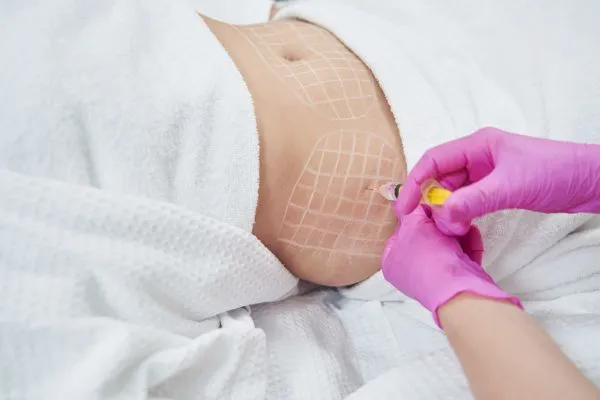 image of fat dissolving injections on love handles to help combat weight gain Weston Super Mare