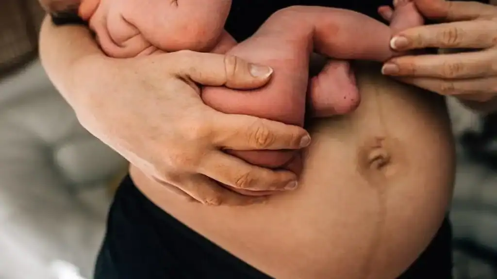 Why Is My Stomach Still Big After Pregnancy Weston Super Mare?